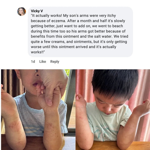 Bloom Manuka™ - Skin Repair Ointment 3.5 Oz